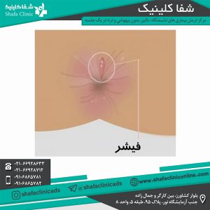 فیشر