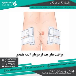 مراقبت های بعد از درمان آبسه مقعدی