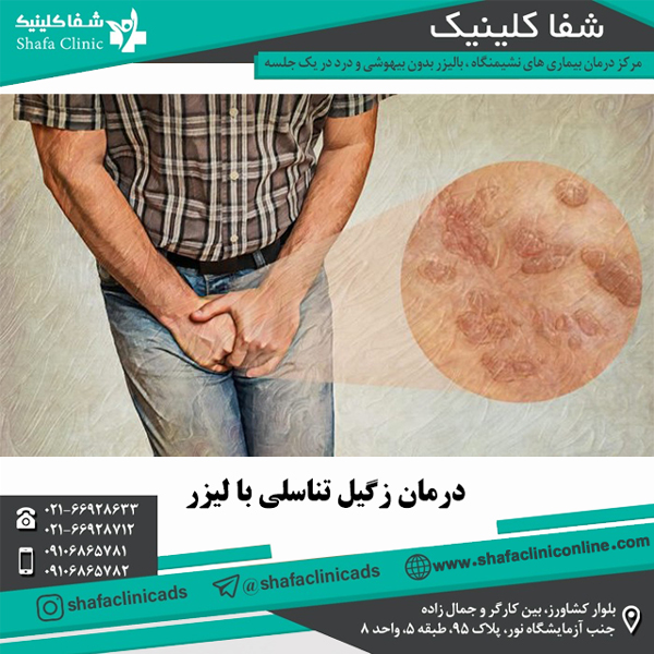 درمان زگیل تناسلی با لیزر