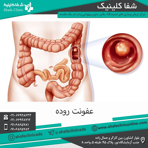 عفونت روده