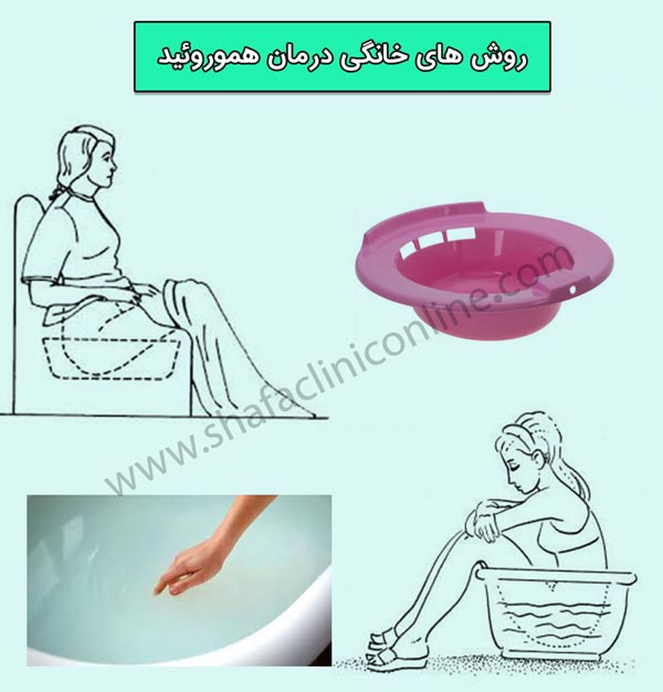 روشهای درمان هموروئید 