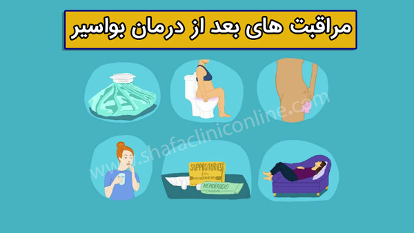 مراقبت های بعد از درمان بواسیر