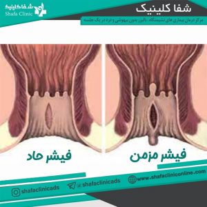 فیشر - شفا کلینیک