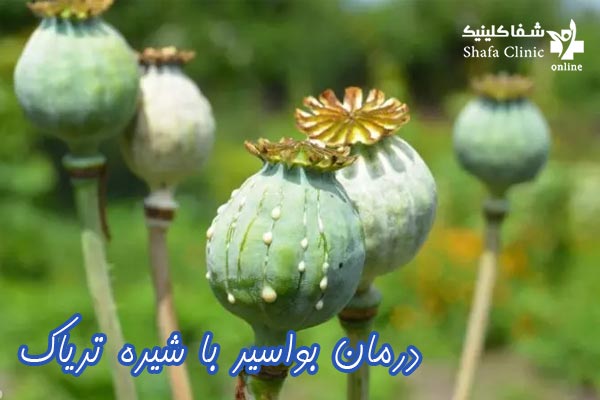 درمان بواسیر در تهران - شفا کلینیک 
