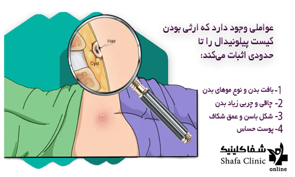 علت ارثی بودن کیست مویی