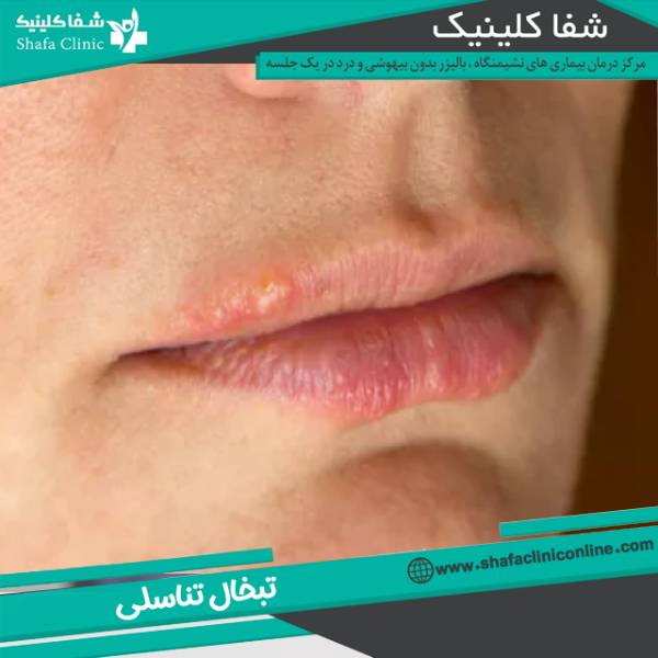 عکس تبخال تناسلی زنان 