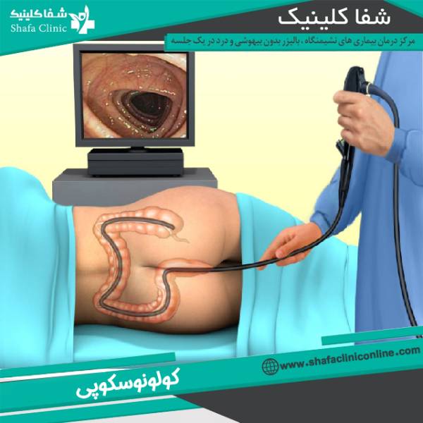 عکس کولونسکوپی