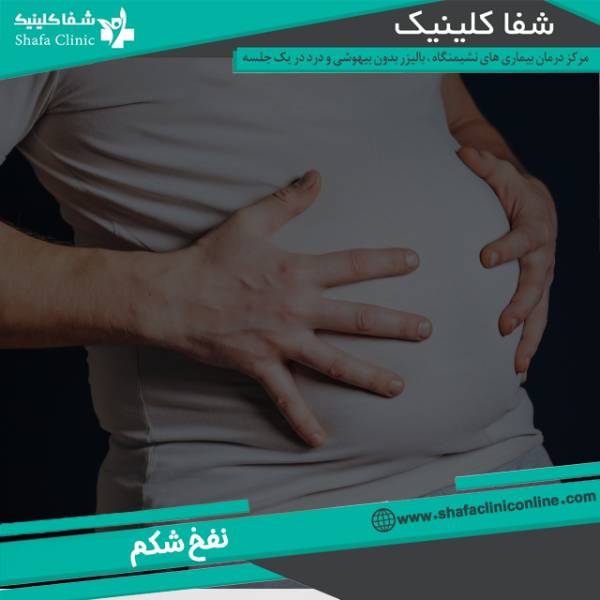 نفخ شکم