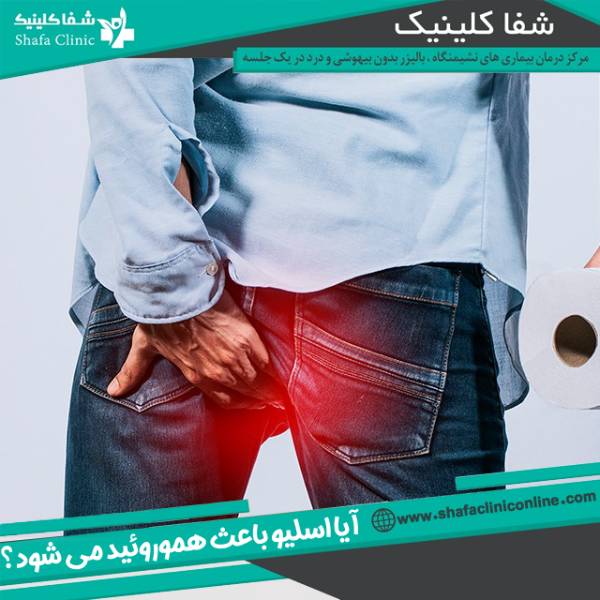هموروئید در اثر اسلیو