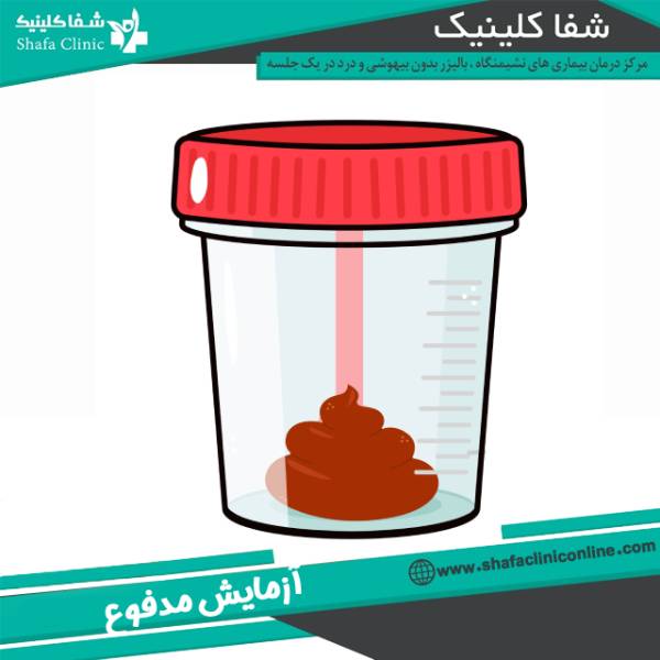آزمایش مدفوع