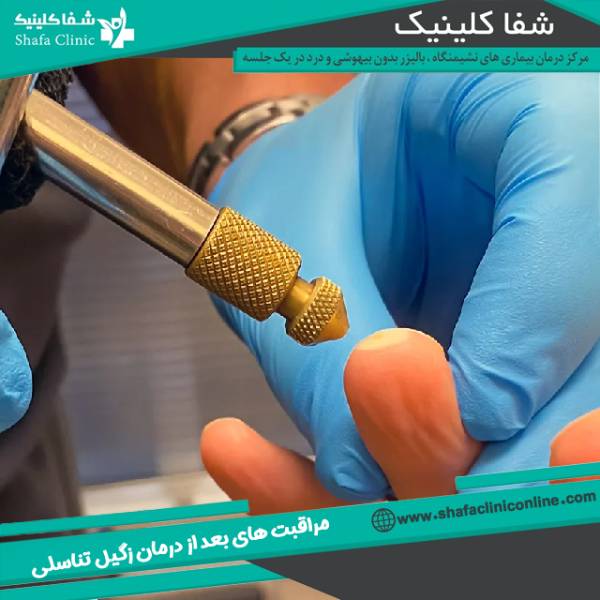 مراقبت های بعد از درمان زگیل تناسلی