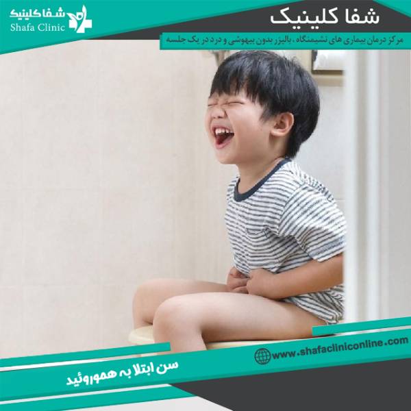 سن ابلا به هموروئید