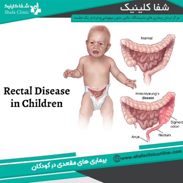 بیماری های مقعدی کودکان