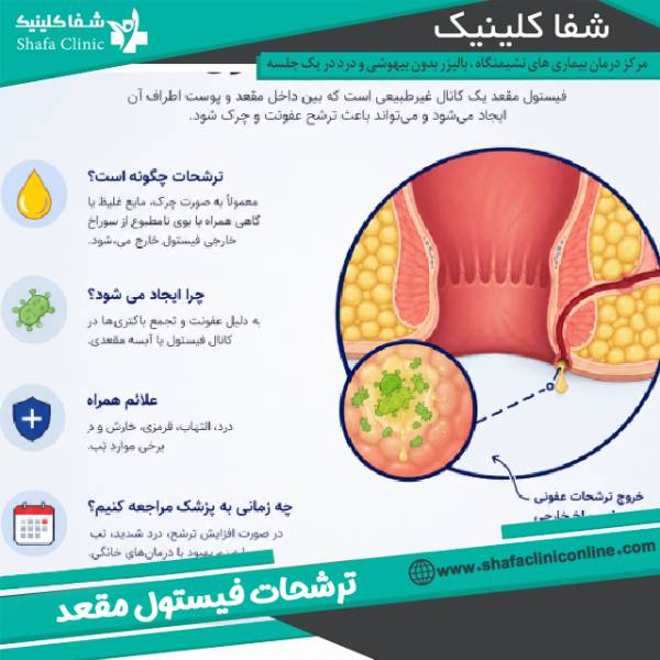 ترشحات فیستول مقعد