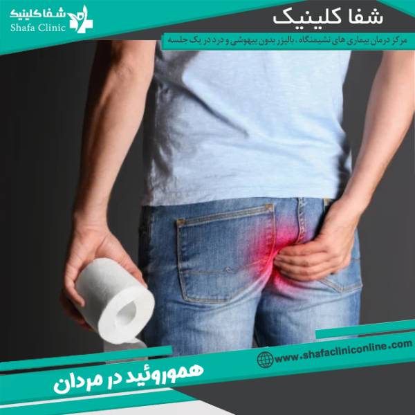 هموروئید در مردان