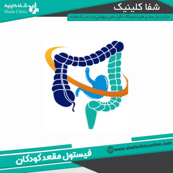 فیستول مقعد در نوزاد و کودکان
